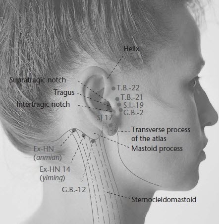 Mastoid bone infection