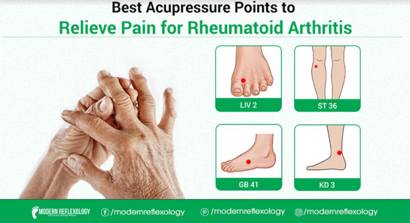 Rheumatoid Arthritis