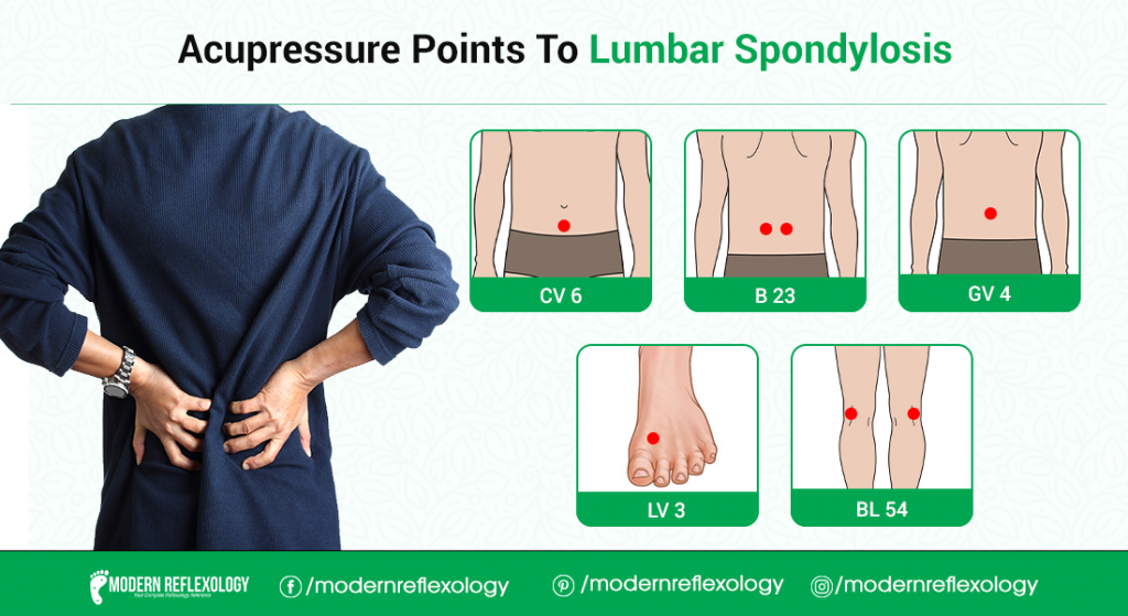 Acupressure Points For Treating Lumbar Spondylosis Modern Reflexology