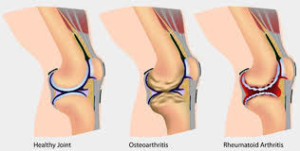 forms of joints