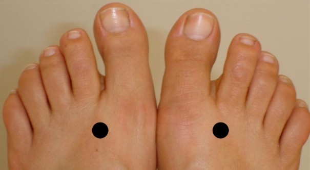 Feet Pressure Points to Control Diabetes