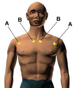 Asthma 3rd point