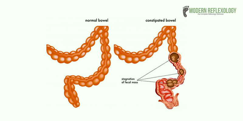 Causes of Constipation