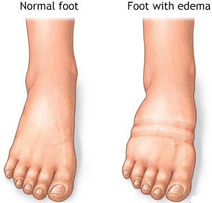 Lower Leg Reflexology Chart