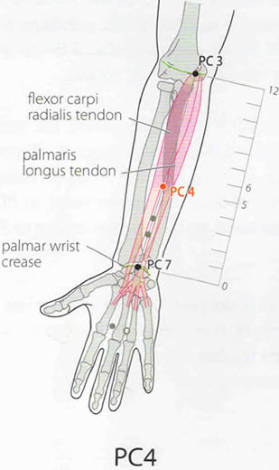 Acupuncture Points Arm Chart