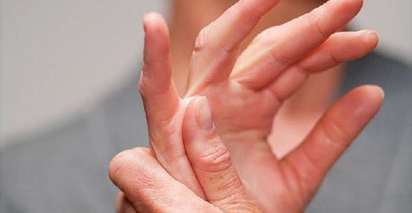 Rheumatoid Arthritis and its Severity