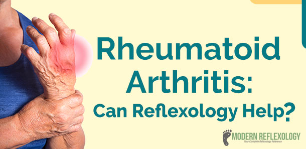 Rheumatoid Arthritis