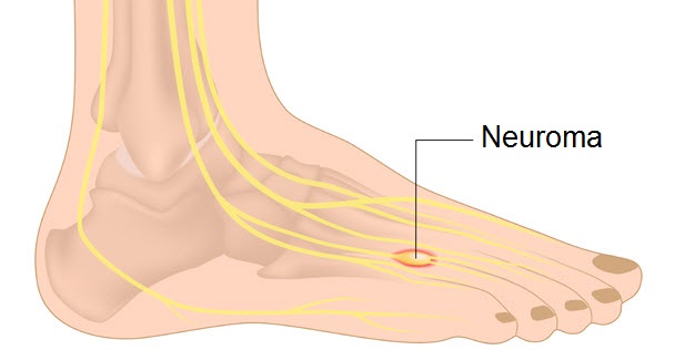 Nerve Endings In Feet Chart