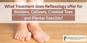 bunions-calluses-crookedtoes