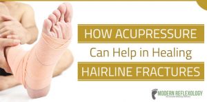 healing-hairline-fractures