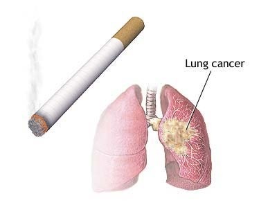 Ill-effects-of-smoking