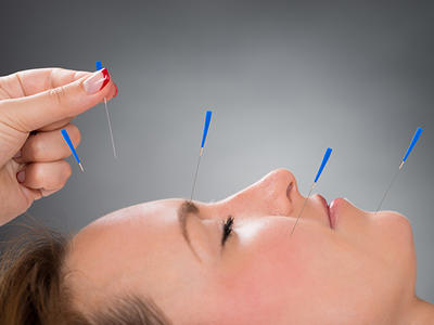 acupuncture for skin problems