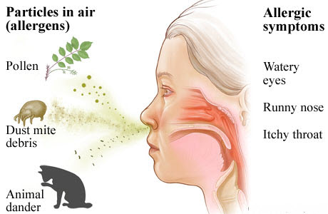 symptoms-of-allergies