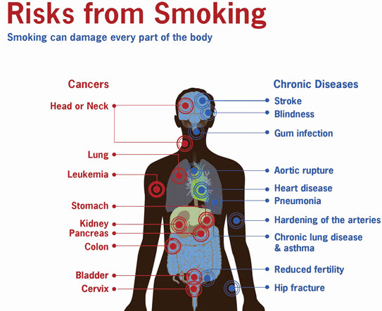 health-risks-of-passive