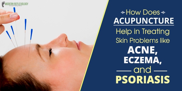 acupuncture points for skin problems