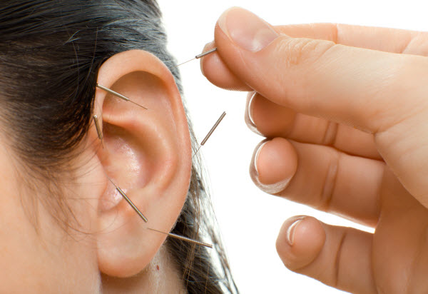 acupuncture-earmark