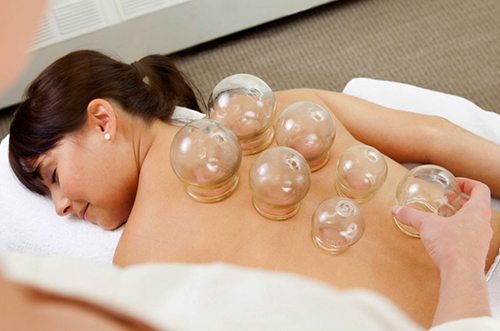 acupuncture-and-cupping