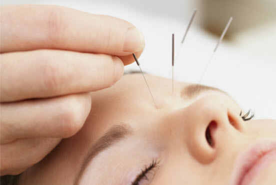 acupuncture-for-weight-loss