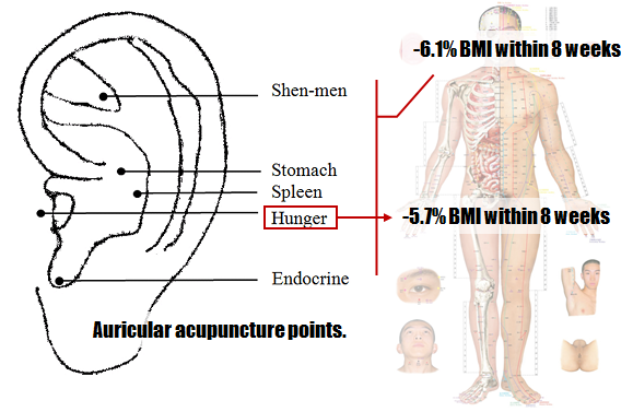 acupuncture-treatments