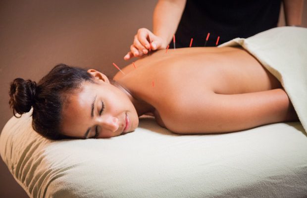 acupuncture-treatment