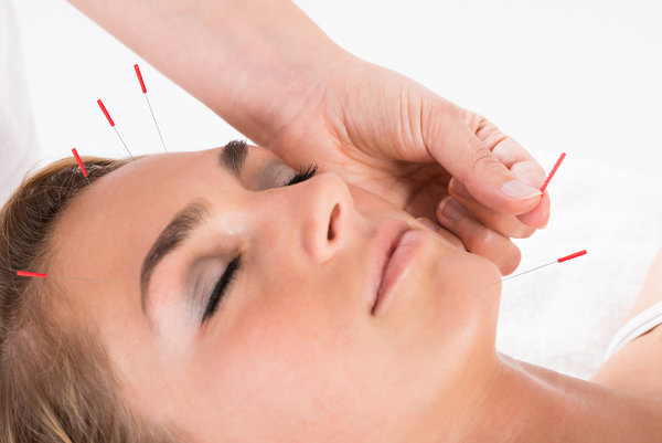 acupuncture-treatments