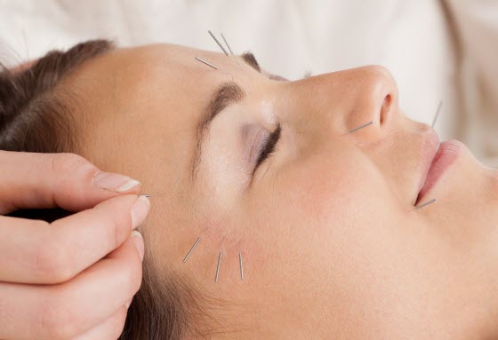 acupuncture-for-chronic-fatigue