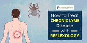 chronic-lyme-disease