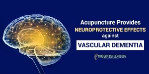 vascular-dementia