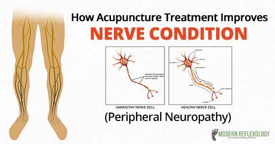 peripheralneuropathy