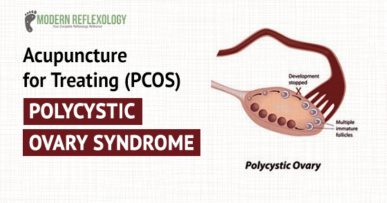 Polycystic-Ovary-Syndrome