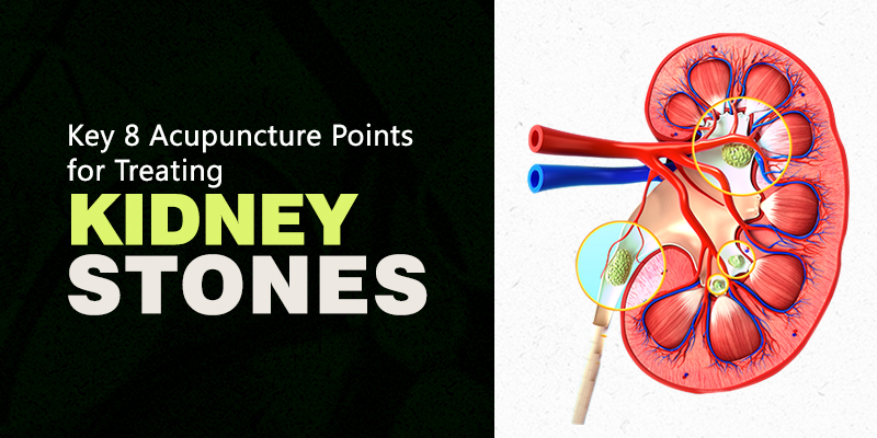 Kidney-Stone-Acupuncture
