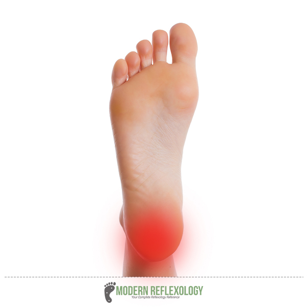 Reflexology Chart For Plantar Fasciitis