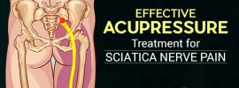 sciatica nerve pain acupressure points