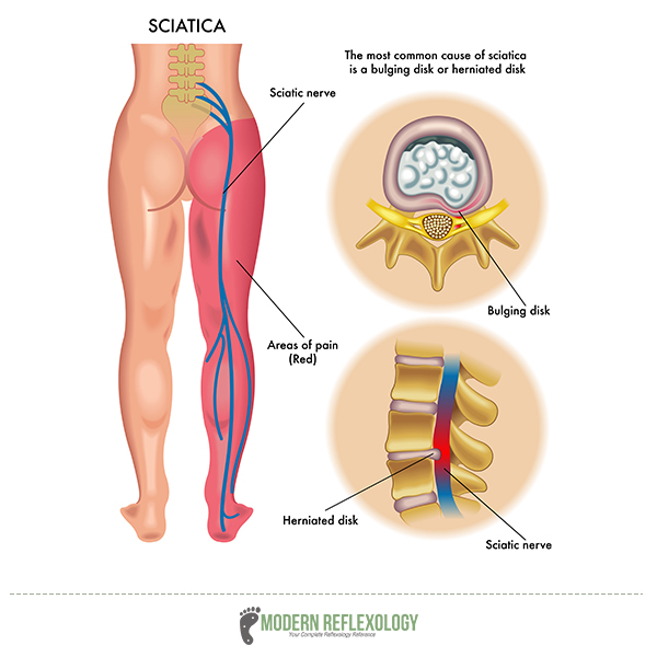 Spinal Pressure Points Chart