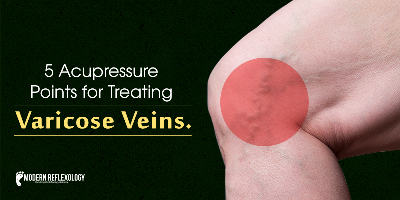 varicoseveins