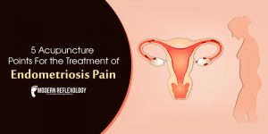 endometriosis