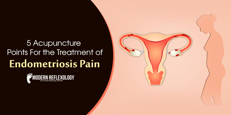 endometriosis