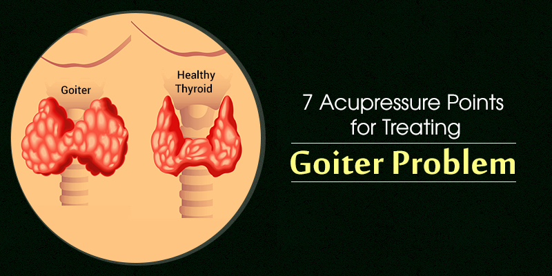 goiter