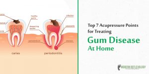 Gum-Disease