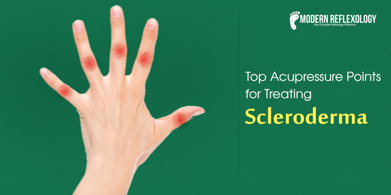 Acupressure Points for Scleroderma