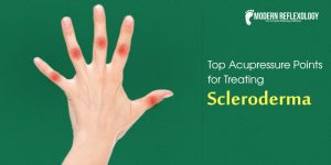 scleroderma