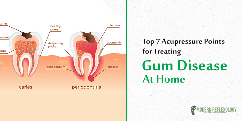 Periodontal Gum Chart