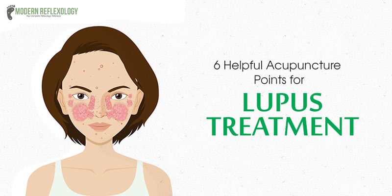 lupus