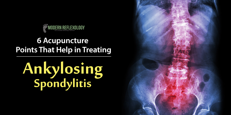 Ankylosing-Spondylitis