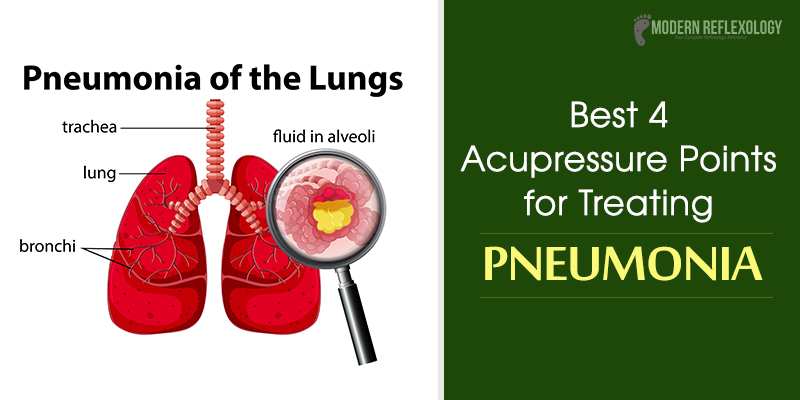 Pneumonia of the lungs
