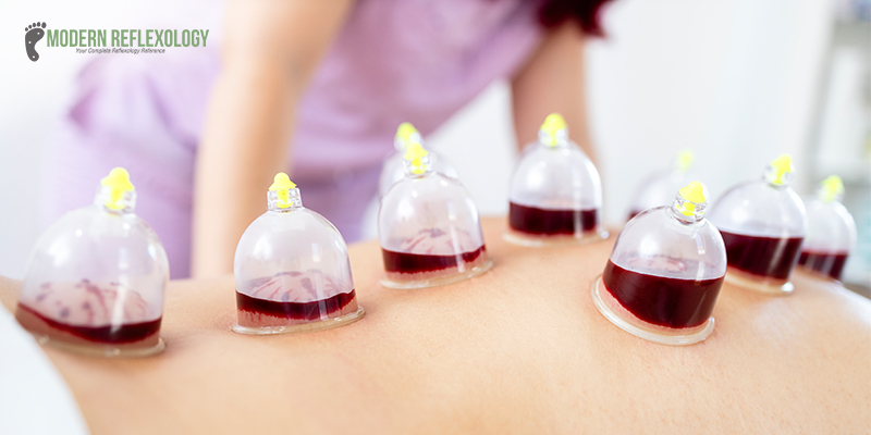 Bleeding Cupping Therapy