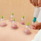 Cupping Therapy 85x85