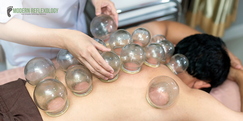 Dry cupping therapy